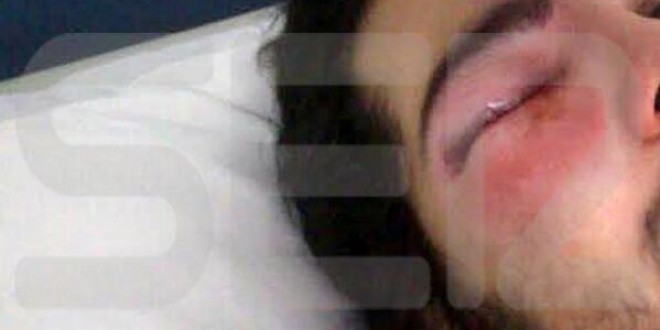 Comunicat del CE del PCPE i del BP dels CJC en resposta a l’agressió policial soferta per Iñaki, militant dels CJC.